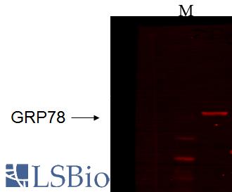 HSPA5 / GRP78 / BiP Antibody - IHC analysis of Grp78 using HSPA5 / GRP78 / BIP antibody.