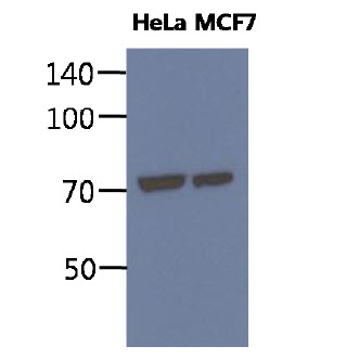 HSPA5 / GRP78 / BiP Antibody - The cell lysates of HeLa and MCF7 (40ug) were resolved by SDS-PAGE, transferred to PVDF membrane and probed with anti-human BIP antibody (1:1000). Proteins were visualized using a goat anti-mouse secondary antibody conjugated to HRP and an ECL detection system.