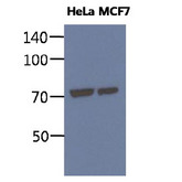 HSPA5 / GRP78 / BiP Antibody - The cell lysates of HeLa and MCF7 (40ug) were resolved by SDS-PAGE, transferred to PVDF membrane and probed with anti-human BIP antibody (1:1000). Proteins were visualized using a goat anti-mouse secondary antibody conjugated to HRP and an ECL detection system.