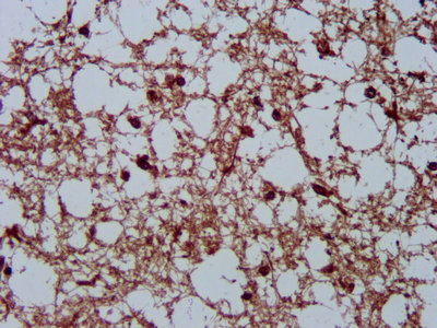 HSPA5 / GRP78 / BiP Antibody - IHC image of HSPA5 Antibody diluted at 1:200 and staining in paraffin-embedded human brain tissue performed on a Leica BondTM system. After dewaxing and hydration, antigen retrieval was mediated by high pressure in a citrate buffer (pH 6.0). Section was blocked with 10% normal goat serum 30min at RT. Then primary antibody (1% BSA) was incubated at 4°C overnight. The primary is detected by a biotinylated secondary antibody and visualized using an HRP conjugated SP system.