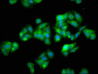 HSPA5 / GRP78 / BiP Antibody - Immunofluorescence staining of HepG2 cells with HSPA5 Antibody at 1:66, counter-stained with DAPI. The cells were fixed in 4% formaldehyde, permeabilized using 0.2% Triton X-100 and blocked in 10% normal Goat Serum. The cells were then incubated with the antibody overnight at 4°C. The secondary antibody was Alexa Fluor 488-congugated AffiniPure Goat Anti-Rabbit IgG(H+L).