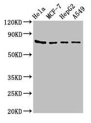 HSPA5 / GRP78 / BiP Antibody - Western Blot Positive WB detected in: Hela whole cell lysate, MCF-7 whole cell lysate, HepG2 whole cell lysate, A549 whole cell lysate All lanes: HSPA5 antibody at 4µg/ml Secondary Goat polyclonal to rabbit IgG at 1/50000 dilution Predicted band size: 73 kDa Observed band size: 73 kDa