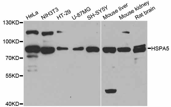 HSPA5 / GRP78 / BiP Antibody - Western blot analysis of extracts of various cell lines.