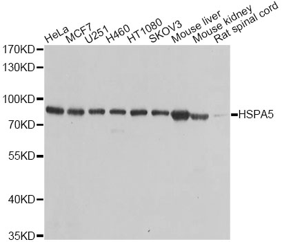 HSPA5 / GRP78 / BiP Antibody - Western blot analysis of extracts of various cell lines, using HSPA5 antibody at 1:1000 dilution. The secondary antibody used was an HRP Goat Anti-Rabbit IgG (H+L) at 1:10000 dilution. Lysates were loaded 25ug per lane and 3% nonfat dry milk in TBST was used for blocking. An ECL Kit was used for detection and the exposure time was 1s.