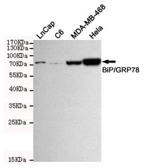HSPA5 / GRP78 / BiP Antibody - Western blot detection of BiP/GRP78 (C-terminus) in HeLa, C6, Lncap and MDA-MB-468 cell lysates using BiP/GRP78 (C-terminus) mouse monoclonal antibody (1:1000 dilution). Predicted band size: 72KDa. Observed band size:78KDa.