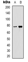 HSPA5 / GRP78 / BiP Antibody - Western blot analysis of GRP78 expression in HeLa (A); rat liver (B) whole cell lysates.