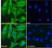 HSPA5 / GRP78 / BiP Antibody - HSPA5 / GRP78 / BiP antibody immunofluorescence analysis of paraformaldehyde fixed HeLa cells, permeabilized with 0.15% Triton. Primary incubation 1hr (5ug/ml) followed by Alexa Fluor 488 secondary antibody (2ug/ml), showing cytoplasmic staining. The nuclear stain is DAPI (blue). Negative control: Unimmunized goat IgG (10ug/ml) followed by Alexa Fluor 488 secondary antibody (2ug/ml).