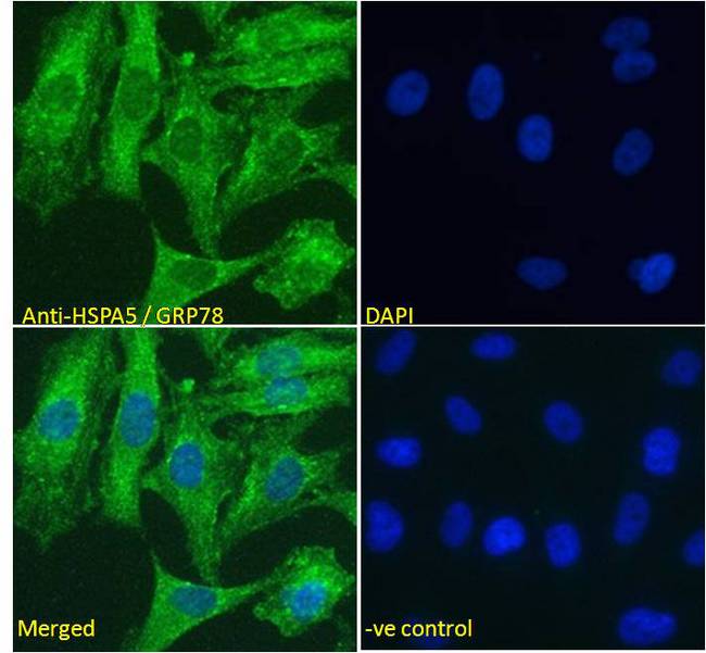 Anti-HSPA5 / GRP78 / BiP Antibody | Goat anti-Human Polyclonal | LSBio