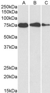 HSPA5 / GRP78 / BiP Antibody - HSPA5 / GRP78 / BiP antibody (0.1µg/ml) staining of HepG2 (A), HeLa (B) and MCF7 (C) cell lysate (35µg protein in RIPA buffer). Detected by chemiluminescence.
