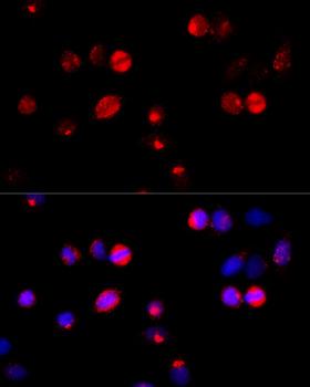 HSPA5 / GRP78 / BiP Antibody - Immunofluorescence analysis of HeLa cells using HSPA5 antibody at dilution of 1:100 (40x lens). Blue: DAPI for nuclear staining.