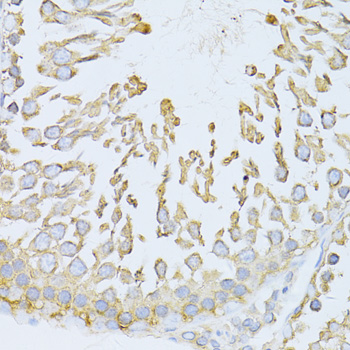 HSPA5 / GRP78 / BiP Antibody - Immunohistochemistry of paraffin-embedded rat testis using HSPA5 antibody at dilution of 1:100 (40x lens).