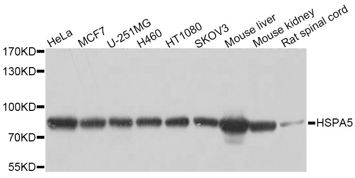 HSPA5 / GRP78 / BiP Antibody - Western blot analysis of extracts of various cell lines, using HSPA5 antibody at 1:1000 dilution. The secondary antibody used was an HRP Goat Anti-Rabbit IgG (H+L) at 1:10000 dilution. Lysates were loaded 25ug per lane and 3% nonfat dry milk in TBST was used for blocking. An ECL Kit was used for detection and the exposure time was 3s.