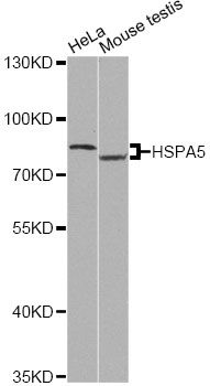 HSPA5 / GRP78 / BiP Antibody - Western blot analysis of extracts of various cell lines, using HSPA5 antibody at 1:500 dilution. The secondary antibody used was an HRP Goat Anti-Rabbit IgG (H+L) at 1:10000 dilution. Lysates were loaded 25ug per lane and 3% nonfat dry milk in TBST was used for blocking. An ECL Kit was used for detection and the exposure time was 90s.