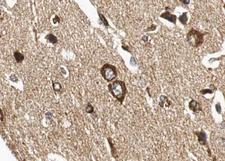 HSPA5 / GRP78 / BiP Antibody - 1:100 staining human brain tissue by IHC-P. The tissue was formaldehyde fixed and a heat mediated antigen retrieval step in citrate buffer was performed. The tissue was then blocked and incubated with the antibody for 1.5 hours at 22°C. An HRP conjugated goat anti-rabbit antibody was used as the secondary.