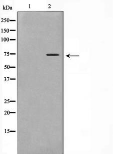 HSPA5 / GRP78 / BiP Antibody - Western blot analysis on COS7 cell lysates using GRP78 antibody. The lane on the left is treated with the antigen-specific peptide.