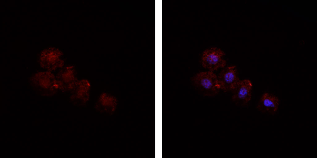 HSPA5 / GRP78 / BiP Antibody - Staining COS7 cells by IF/ICC. The samples were fixed with PFA and permeabilized in 0.1% Triton X-100, then blocked in 10% serum for 45 min at 25°C. The primary antibody was diluted at 1:200 and incubated with the sample for 1 hour at 37°C. An Alexa Fluor 594 conjugated goat anti-rabbit IgG (H+L) Ab, diluted at 1/600, was used as the secondary antibody.