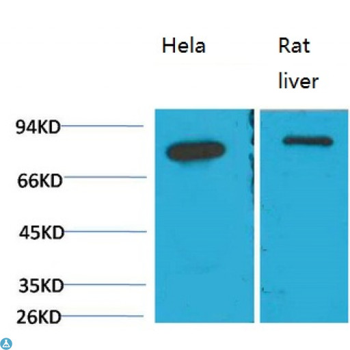 HSPA5 / GRP78 / BiP Antibody - Western Blot (WB) analysis of 1)HeLa, 2) Rat LiverTissue with GRP78/Bip Mouse Monoclonal Antibody diluted at 1:2000.