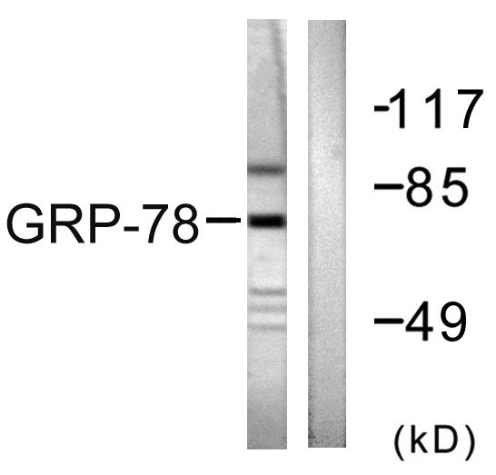 HSPA5 / GRP78 / BiP Antibody - Western blot analysis of extracts from COS7 cells, using GRP78 antibody.