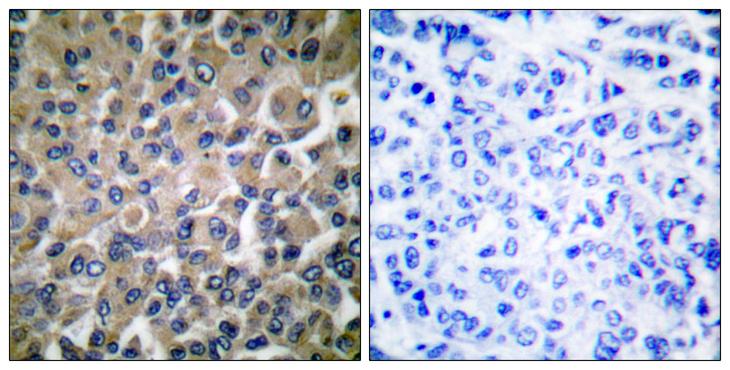 HSPA5 / GRP78 / BiP Antibody - Peptide - + Immunofluorescence analysis of COS7 cells, using GRP78 antibody.