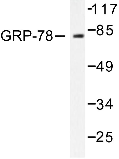 HSPA5 / GRP78 / BiP Antibody - Western blot of GRP78 (P641) pAb in extracts from COS7 cells.
