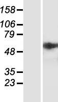 HSPA5 / GRP78 / BiP Protein - Western validation with an anti-DDK antibody * L: Control HEK293 lysate R: Over-expression lysate
