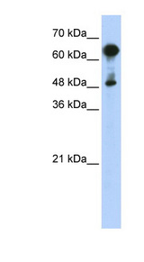 HSPA6 / HSP70B' Antibody - HSPA6 antibody Western blot of Transfected 293T cell lysate. This image was taken for the unconjugated form of this product. Other forms have not been tested.