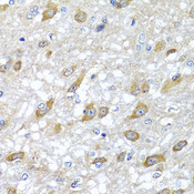 HSPA6 / HSP70B' Antibody - Immunohistochemistry of paraffin-embedded rat brain tissue.