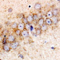 HSPA6 / HSP70B' Antibody - Immunohistochemical analysis of HSPA6 staining in rat brain formalin fixed paraffin embedded tissue section. The section was pre-treated using heat mediated antigen retrieval with sodium citrate buffer (pH 6.0). The section was then incubated with the antibody at room temperature and detected using an HRP conjugated compact polymer system. DAB was used as the chromogen. The section was then counterstained with hematoxylin and mounted with DPX.