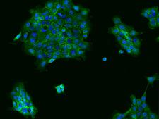 HSPA6 / HSP70B' Antibody - Immunofluorescence staining of HSPA6 in A431 cells. Cells were fixed with 4% PFA, permeabilzed with 0.1% Triton X-100 in PBS, blocked with 10% serum, and incubated with rabbit anti-Human HSPA6 polyclonal antibody (dilution ratio 1:200) at 4°C overnight. Then cells were stained with the Alexa Fluor 488-conjugated Goat Anti-rabbit IgG secondary antibody (green) and counterstained with DAPI (blue). Positive staining was localized to Cytoplasm.