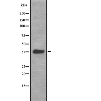HSPA7 Antibody - Western blot analysis of HSP77/76 expression in HEK293 cells. The lane on the left is treated with the antigen-specific peptide.