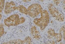 HSPA7 Antibody - 1:100 staining human uterus tissue by IHC-P. The sample was formaldehyde fixed and a heat mediated antigen retrieval step in citrate buffer was performed. The sample was then blocked and incubated with the antibody for 1.5 hours at 22°C. An HRP conjugated goat anti-rabbit antibody was used as the secondary.