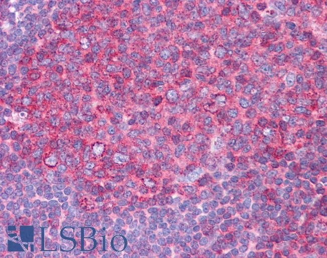 HSPA8 / HSC70 Antibody - Anti-HSPA8 / HSC70 antibody IHC of human tonsil. Immunohistochemistry of formalin-fixed, paraffin-embedded tissue after heat-induced antigen retrieval. Antibody concentration 5 ug/ml.  This image was taken for the unconjugated form of this product. Other forms have not been tested.