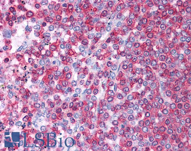 HSPA8 / HSC70 Antibody - Anti-HSPA8 / HSC70 antibody IHC of human spleen. Immunohistochemistry of formalin-fixed, paraffin-embedded tissue after heat-induced antigen retrieval. Antibody concentration 5 ug/ml.  This image was taken for the unconjugated form of this product. Other forms have not been tested.