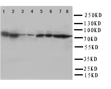 HSPA8 / HSC70 Antibody - WB of HSPA8 / HSC70 antibody. Lane 1: Rat Brain Tissue Lysate. Lane 2: Rat Testis Tissue Lysate. Lane 3:Rat Ovary Tissue Lysate. Lane 4: Rat Spleen Tissue Lysate. Lane 5: A549 Cell Lysate. Lane 6: MCF-7 Cell Lysate. Lane 7: HELA Cell Lysate. Lane 8: JURKAT Cell Lysate.