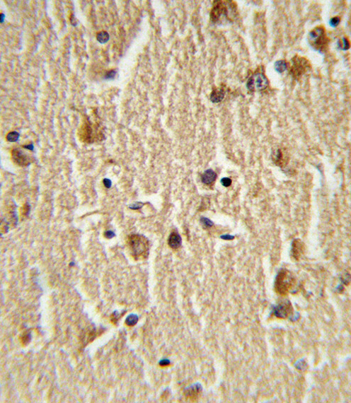 HSPA8 / HSC70 Antibody - Formalin-fixed and paraffin-embedded human brain tissue reacted with HSPA8 Antibody , which was peroxidase-conjugated to the secondary antibody, followed by DAB staining. This data demonstrates the use of this antibody for immunohistochemistry; clinical relevance has not been evaluated.