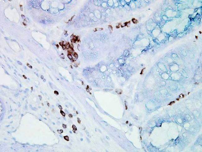 HSPA8 / HSC70 Antibody - Hsp70Hsc70 (BB70), Mouse colon carcinoma.