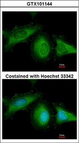 HSPA8 / HSC70 Antibody - Immunofluorescence of methanol-fixed HeLa, using Hsc70 antibody at 1:200 dilution.