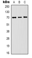 HSPA8 / HSC70 Antibody - Western blot analysis of HSC70 expression in HeLa (A); mouse brain (B); rat brain (C) whole cell lysates.