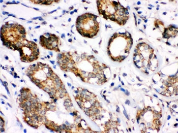 HSPA8 / HSC70 Antibody
