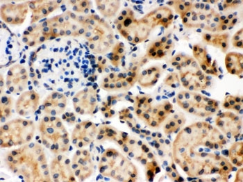 HSPA8 / HSC70 Antibody