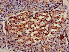 HSPA8 / HSC70 Antibody - Immunohistochemistry of paraffin-embedded human pancreatic tissue using HSPA8 Antibody at dilution of 1:100