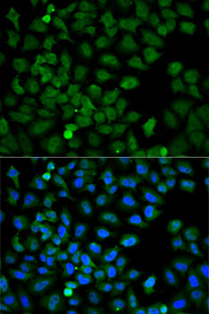 HSPA8 / HSC70 Antibody - Immunofluorescence analysis of HeLa cells using HSPA8 antibody. Blue: DAPI for nuclear staining.