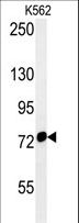 HSPA9 / Mortalin / GRP75 Antibody - HSPA9 Antibody western blot of K562 cell line lysates (35 ug/lane). The HSPA9 antibody detected the HSPA9 protein (arrow).