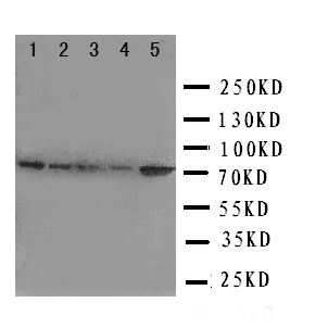 HSPA9 / Mortalin / GRP75 Antibody - WB of HSPA9 / Mortalin / GRP75 antibody. Lane 1: Rat Liver Tissue Lysate. Lane 2: A549 Cell Lysate. Lane 3: 293T Cell Lysate. Lane 4: M431 Cell Lysate. Lane 5: COLO320 Cell Lysate.