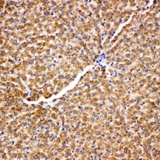 HSPA9 / Mortalin / GRP75 Antibody - HSPA9 / Mortalin / GRP75 antibody. IHC(P): Rat Liver Tissue? ? .
