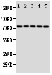 HSPA9 / Mortalin / GRP75 Antibody - Anti-Grp75 antibody, Western blotting All lanes: Anti Grp75 at 0.5ug/ml Lane 1: Rat Liver Tissue Lysate at 50ugLane 2: A549 Whole Cell Lysate at 40ugLane 3: 293T Whole Cell Lysate at 40ugLane 4: M431 Whole Cell Lysate at 40ugLane 5: COLO320 Whole Cell Lysate at 40ugPredicted bind size: 74KD Observed bind size: 74KD