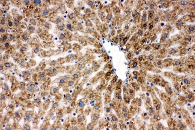 HSPA9 / Mortalin / GRP75 Antibody - IHC analysis of Grp75 using anti-Grp75 antibody. Grp75 was detected in frozen section of rat liver tissues. Heat mediated antigen retrieval was performed in citrate buffer (pH6, epitope retrieval solution) for 20 mins. The tissue section was blocked with 10% goat serum. The tissue section was then incubated with 1µg/ml rabbit anti-Grp75 Antibody overnight at 4°C. Biotinylated goat anti-rabbit IgG was used as secondary antibody and incubated for 30 minutes at 37°C. The tissue section was developed using Strepavidin-Biotin-Complex (SABC) with DAB as the chromogen.