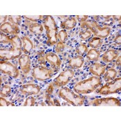 HSPA9 / Mortalin / GRP75 Antibody - Grp75 antibody IHC-paraffin. IHC(P): Mouse Kidney Tissue.