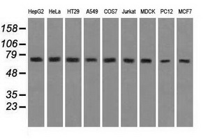 HSPA9 / Mortalin / GRP75 Antibody - Western blot analysis of extracts (35ug) from 9 different cell lines by using anti-HSPA9 monoclonal antibody.