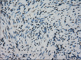 HSPA9 / Mortalin / GRP75 Antibody - Immunohistochemical staining of paraffin-embedded endometrium tissue using antiHSPA9 mouse monoclonal antibody. (Dilution 1:50).